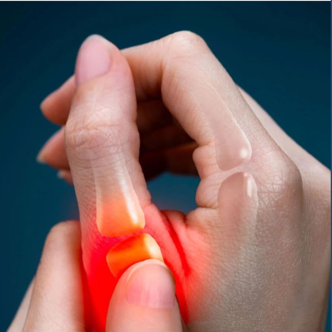 Vexol | ThumbBrace against arthritis